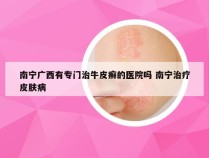 南宁广西有专门治牛皮癣的医院吗 南宁治疗皮肤病