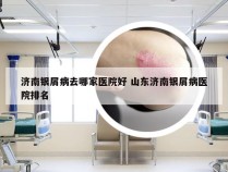 济南银屑病去哪家医院好 山东济南银屑病医院排名