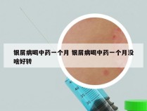 银屑病喝中药一个月 银屑病喝中药一个月没啥好转