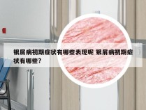银屑病初期症状有哪些表现呢 银屑病初期症状有哪些?