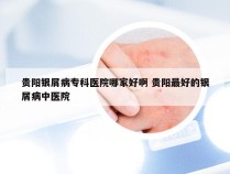 贵阳银屑病专科医院哪家好啊 贵阳最好的银屑病中医院