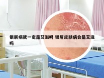 银屑病就一定是艾滋吗 银屑皮肤病会是艾滋吗
