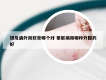 银屑病外用软膏哪个好 银屑病用哪种外擦药好