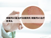 碳酸钙d3能治疗白癜风吗 碳酸钙d3治疗脱发么