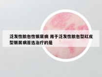 泛发性脓包性银屑病 用于泛发性脓包型红皮型银屑病首选治疗的是