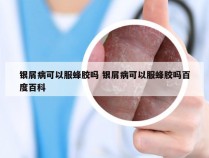 银屑病可以服蜂胶吗 银屑病可以服蜂胶吗百度百科
