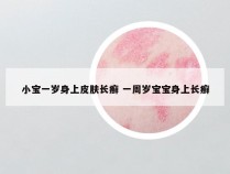 小宝一岁身上皮肤长癣 一周岁宝宝身上长癣