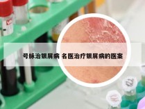 号脉治银屑病 名医治疗银屑病的医案