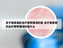 关于银屑病的治疗原则错误的是 关于银屑病的治疗原则错误的是什么