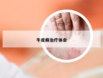 牛皮癣治疗体会
