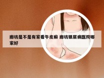 廊坊是不是有家看牛皮癣 廊坊银屑病医院哪家好
