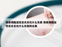 银屑病脂溢性皮炎忌吃什么东西 银屑病脂溢性皮炎忌吃什么东西和水果