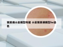银屑病小鼠模型构建 小鼠银屑病模型he染色