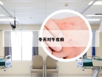 冬天对牛皮癣