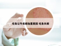 吃鱼让牛皮癣加重原因 吃鱼长癣