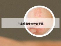 牛皮癣患者吃什么干果