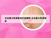 立元堂小乳膏能治牛皮癣吗 立元堂小乳膏禁忌