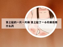 背上起的一片一片癣 背上起了一小片癣该用什么药