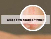 万金油治牛皮癣 万金油能治疗皮肤痒不