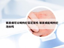 银屑病可以喝枸杞菊花茶吗 银屑病能喝枸杞泡水吗
