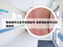 银屑病可以走平安保险吗 银屑病患者可以买保险吗