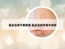 莲必治用于银屑病 莲必治的作用与功效