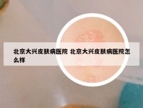 北京大兴皮肤病医院 北京大兴皮肤病医院怎么样