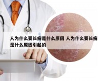 人为什么要长癣是什么原因 人为什么要长癣是什么原因引起的