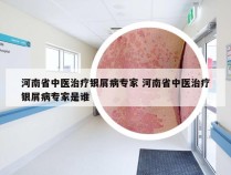 河南省中医治疗银屑病专家 河南省中医治疗银屑病专家是谁