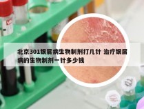 北京301银屑病生物制剂打几针 治疗银屑病的生物制剂一针多少钱