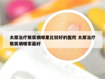 太原治疗银屑病哪里比较好的医院 太原治疗银屑病哪家最好