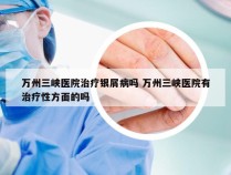 万州三峡医院治疗银屑病吗 万州三峡医院有治疗性方面的吗
