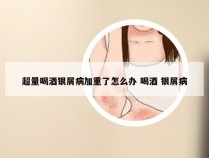 超量喝酒银屑病加重了怎么办 喝酒 银屑病