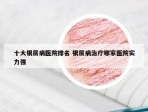 十大银屑病医院排名 银屑病治疗哪家医院实力强