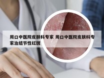 周口中医院皮肤科专家 周口中医院皮肤科专家治结节性红斑