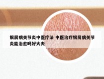 银屑病关节炎中医疗法 中医治疗银屑病关节炎能治愈吗好大夫