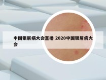 中国银屑病大会直播 2020中国银屑病大会
