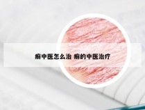 癣中医怎么治 癣的中医治疗