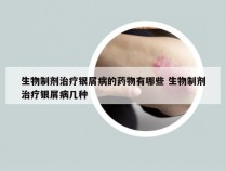 生物制剂治疗银屑病的药物有哪些 生物制剂治疗银屑病几种