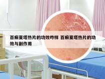 百癣夏塔热片的功效咋样 百癣夏塔热片的功效与副作用