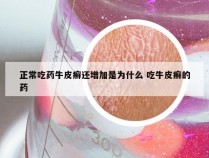 正常吃药牛皮癣还增加是为什么 吃牛皮癣的药