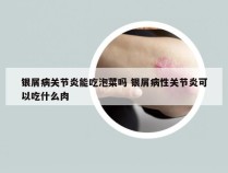 银屑病关节炎能吃泡菜吗 银屑病性关节炎可以吃什么肉