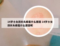 14岁小女孩长头癣是什么原因 14岁小女孩长头癣是什么原因呢