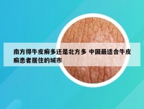 南方得牛皮癣多还是北方多 中国最适合牛皮癣患者居住的城市