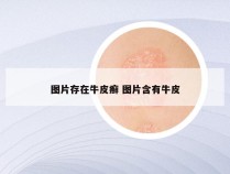图片存在牛皮癣 图片含有牛皮