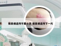 银屑病遗传不要小孩 银屑病遗传下一代