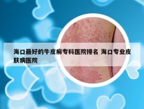 海口最好的牛皮癣专科医院排名 海口专业皮肤病医院