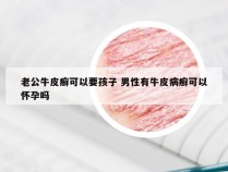 老公牛皮癣可以要孩子 男性有牛皮病癣可以怀孕吗