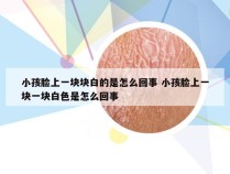 小孩脸上一块块白的是怎么回事 小孩脸上一块一块白色是怎么回事