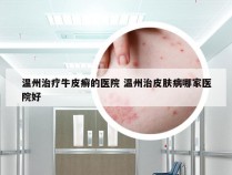温州治疗牛皮癣的医院 温州治皮肤病哪家医院好